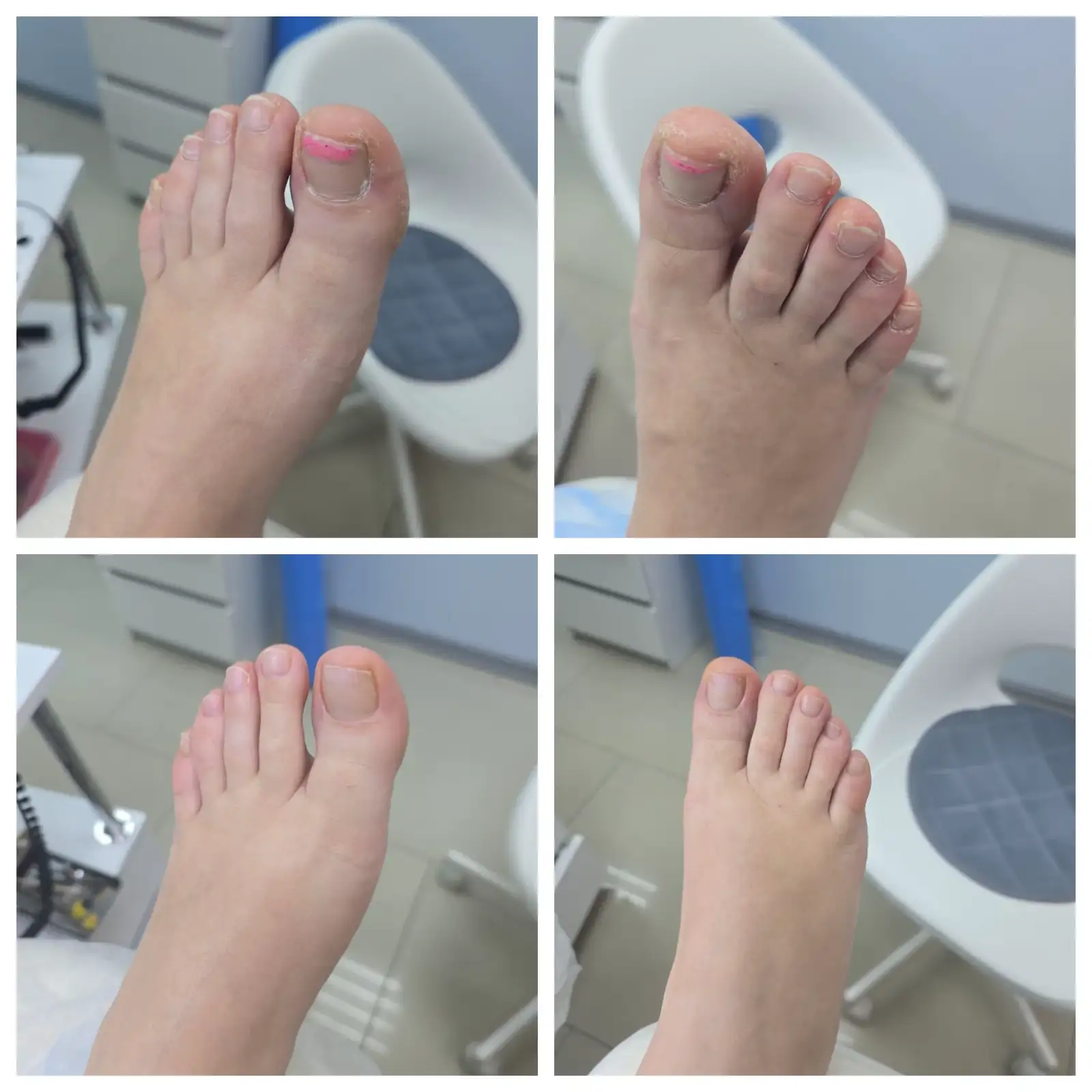 Обработка трещин