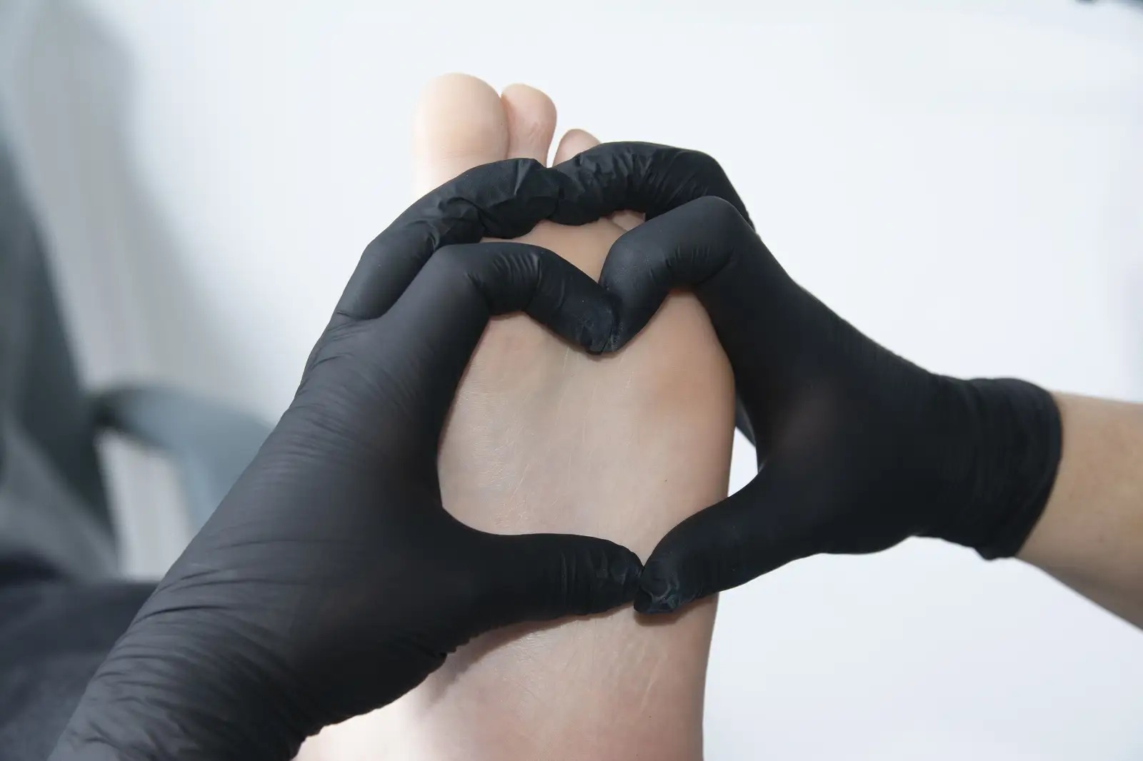 Обработка бородавок